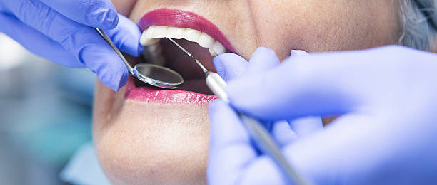 Best Emergency Treatment for Oral Infections in Tipton, IA