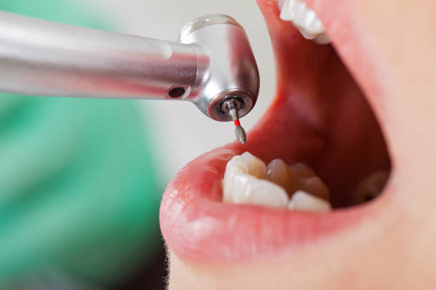 Best Emergency Denture Repair in Tipton, IA